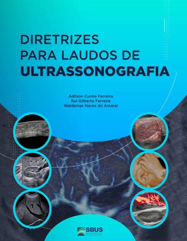 E-Book Diretrizes Para Laudos de Ultrassonografia